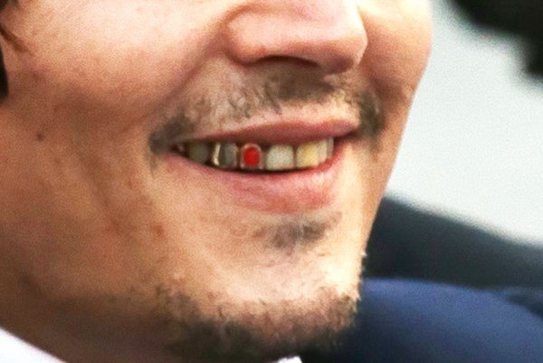 Johnny Depps tänder