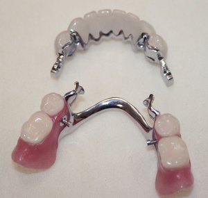 Karakteristisk beskrivning av bugel dental strukturer