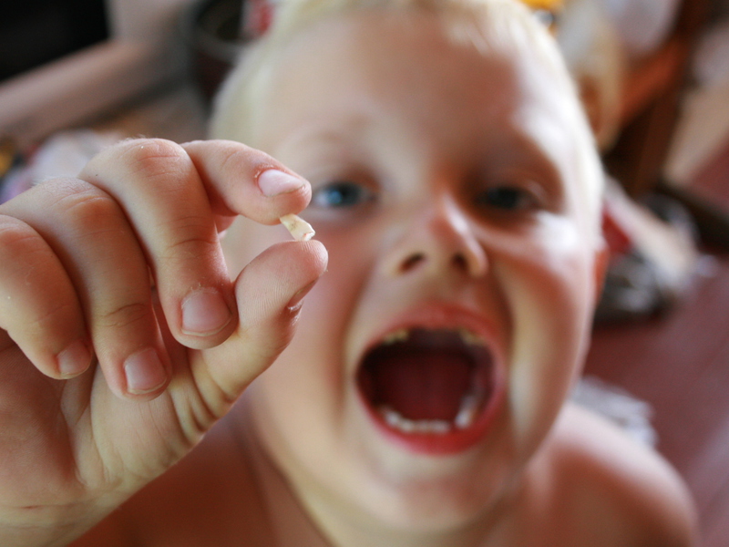 Primär tandförlust Baby tänder och deras förändring till permanent