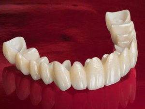 Dentures och deras typer