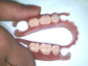 Diverse sortiment av artificiella lemmar
